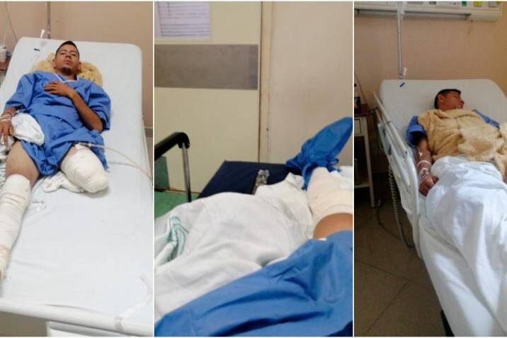 Drama de colombiano que en México perdió una pierna tras accidente con un tren 