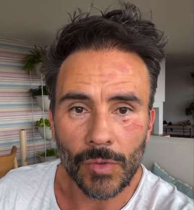 Roban a reconocido actor en los cerros orientales de Bogotá  