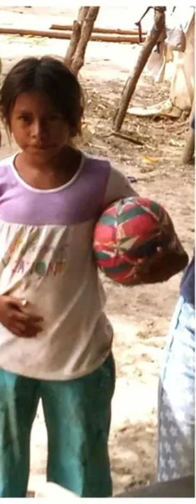 Niña muere y su hermano agoniza por comida envenenada de la basura