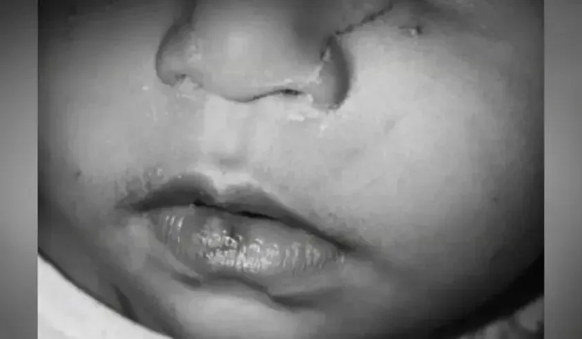Niña habría sido golpeada en jardín infantil en Bogotá