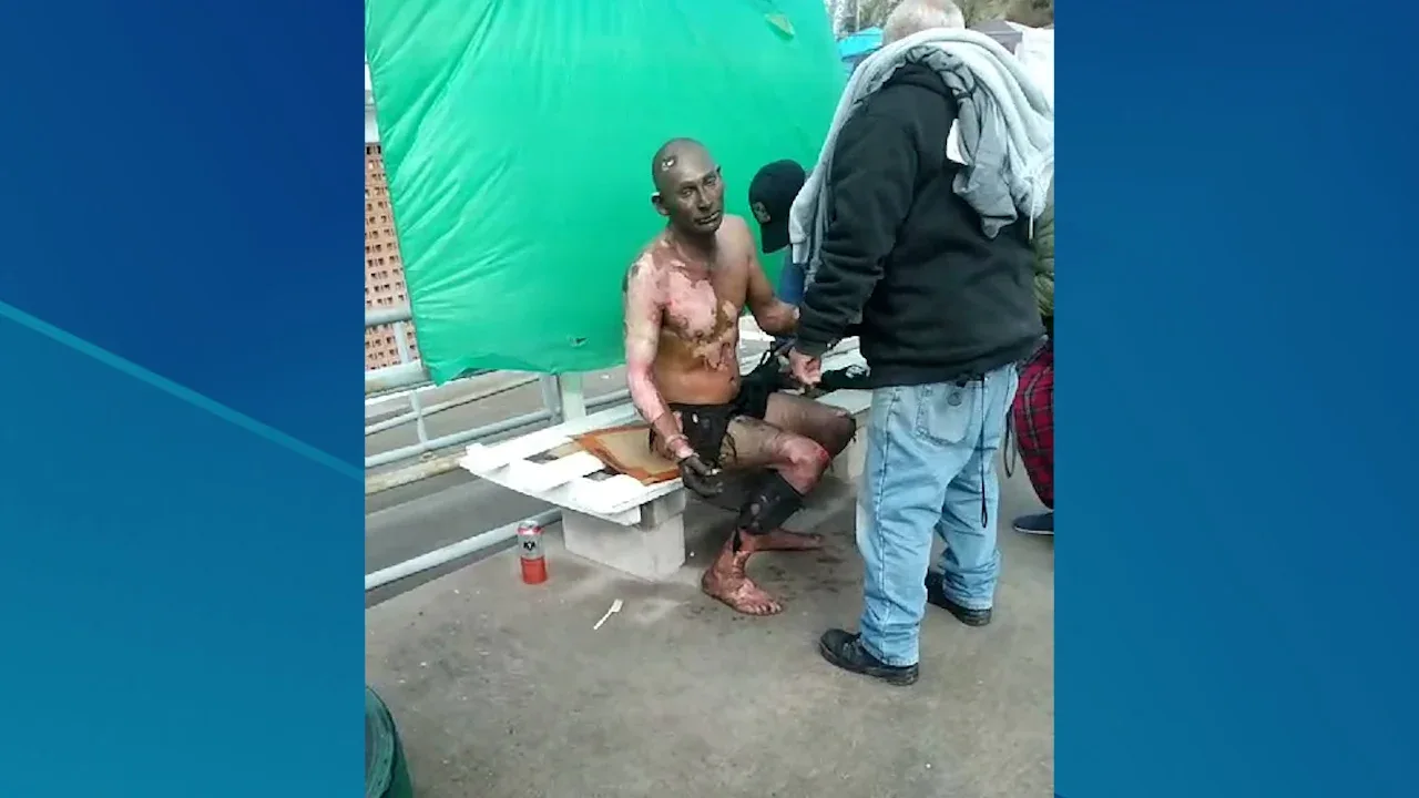 Hombre sobrevive a quemaduras tras emergencia en el Parque de Casas BETA